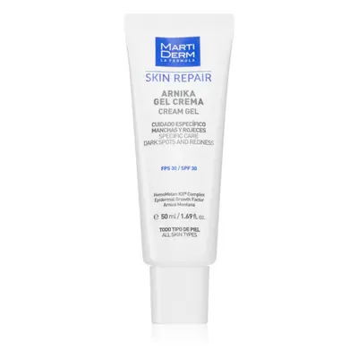 MartiDerm Skin Repair géles krém a sötét foltok ellen SPF 30 50 ml