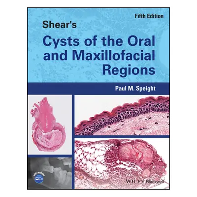 "Shear's Cysts of the Oral and Maxillofacial Regions" - "" ("Speight Paul M.")