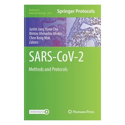 "Sars-Cov-2: Methods and Protocols" - "" ("Chu Justin Jang Hann")