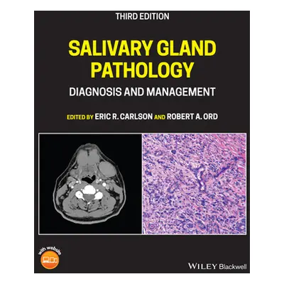 "Salivary Gland Pathology: Diagnosis and Management" - "" ("Carlson Eric R.")