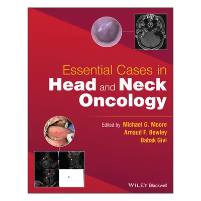 "Essential Cases in Head and Neck Oncology" - "" ("Moore Michael G.")