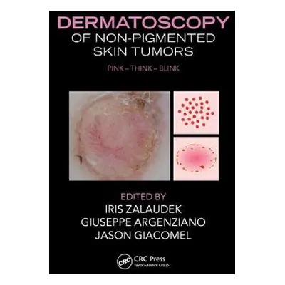 "Dermatoscopy of Non-Pigmented Skin Tumors: Pink-Think-Blink" - "" ("Zalaudek Iris")