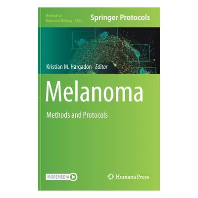 "Melanoma: Methods and Protocols" - "" ("Hargadon Kristian M.")