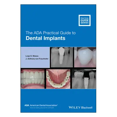 "The ADA Practical Guide to Dental Implants" - "" ("Massa Luigi O.")