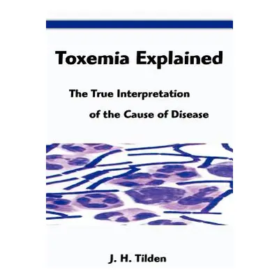 "Toxemia Explained: The True Interpretation of the Cause of Disease" - "" ("Tilden John H.")