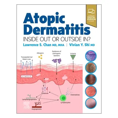 "Atopic Dermatitis: Inside Out or Outside in" - "" ("Chan Lawrence S.")