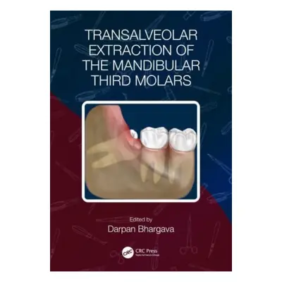 "Transalveolar Extraction of the Mandibular Third Molars" - "" ("Bhargava Darpan")