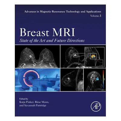 "Breast MRI: State of the Art and Future Directions Volume 5" - "" ("Pinker Katja")