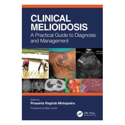 "Clinical Melioidosis: A Practical Guide to Diagnosis and Management" - "" ("Raghab Mohapatra Pr