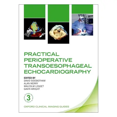 "Practical Perioperative Transoesophageal Echocardiography" - "" ("Sidebotham David")