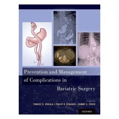 "Prevention and Management of Complications in Bariatric Surgery" - "" ("Rogula Tomasz G.")