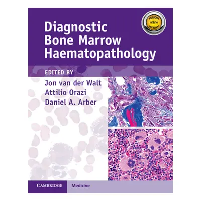 "Diagnostic Bone Marrow Haematopathology Book with Online Content" - "" ("Van Der Walt Jon")