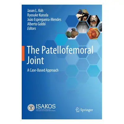 "The Patellofemoral Joint: A Case-Based Approach" - "" ("Koh Jason L.")