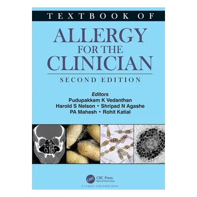 "Textbook of Allergy for the Clinician" - "" ("Vedanthan Pudupakkam K.")