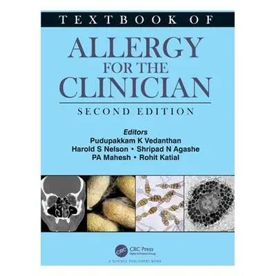 "Textbook of Allergy for the Clinician" - "" ("Mahesh Pa")