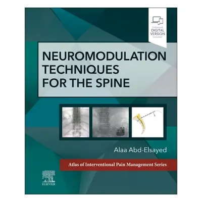 "Neuromodulation Techniques for the Spine: A Volume in the Atlas of Interventional Pain Manageme