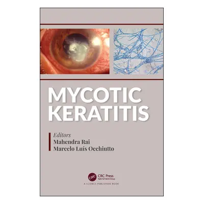 "Mycotic Keratitis" - "" ("Rai Mahendra")