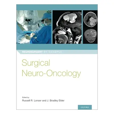 "Surgical Neuro-Oncology" - "" ("Lonser Russell R.")