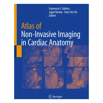 "Atlas of Non-Invasive Imaging in Cardiac Anatomy" - "" ("Faletra Francesco F.")