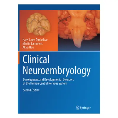 "Clinical Neuroembryology: Development and Developmental Disorders of the Human Central Nervous 