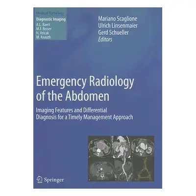 "Emergency Radiology of the Abdomen: Imaging Features and Differential Diagnosis for a Timely Ma