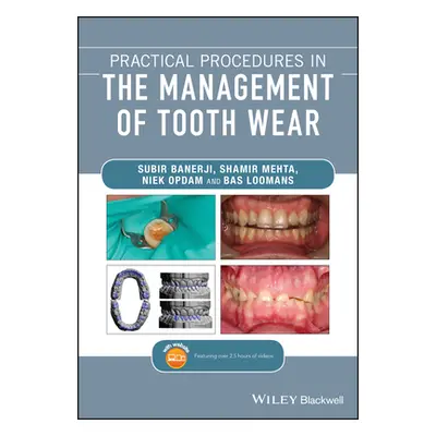 "Practical Procedures in the Management of Tooth Wear" - "" ("Banerji Subir")