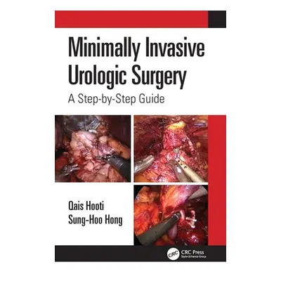 "Minimally Invasive Urologic Surgery: A Step-By-Step Guide" - "" ("Hooti Qais")