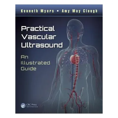 "Practical Vascular Ultrasound: An Illustrated Guide" - "" ("Myers Kenneth")