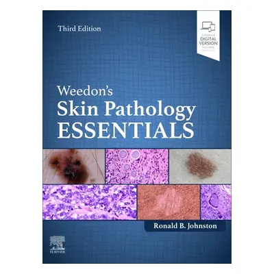 "Weedon's Skin Pathology Essentials" - "" ("Johnston Ronald")