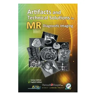 "Artifacts and Technical Solutions in MR Diagnostic Imaging" - "" ("Gerevini Alan")