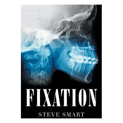 "Fixation" - "" ("Smart Steve")