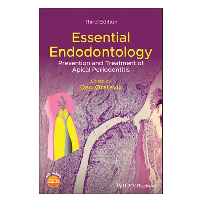 "Essential Endodontology: Prevention and Treatment of Apical Periodontitis" - "" ("Orstavik Dag"