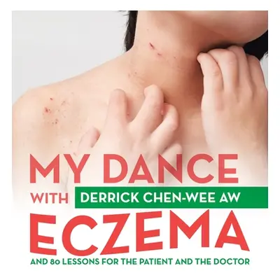 "My Dance with Eczema: And 80 Lessons for the Patient and the Doctor" - "" ("Chen-Wee Aw Derrick