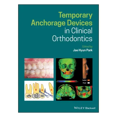 "Temporary Anchorage Devices in Clinical Orthodontics" - "" ("Park Jae Hyun")