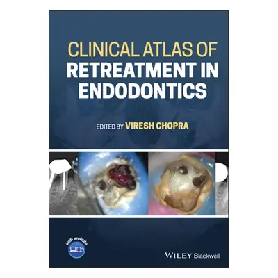 "Clinical Atlas of Retreatment in Endodontics" - "" ("Chopra Viresh")