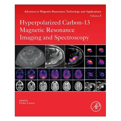 "Hyperpolarized Carbon-13 Magnetic Resonance Imaging and Spectroscopy, 3" - "" ("Larson Peder")