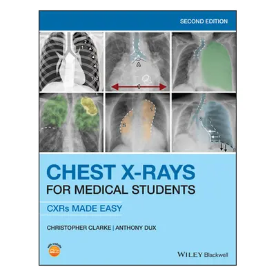 "Chest X-Rays for Medical Students: Cxrs Made Easy" - "" ("Clarke Christopher")