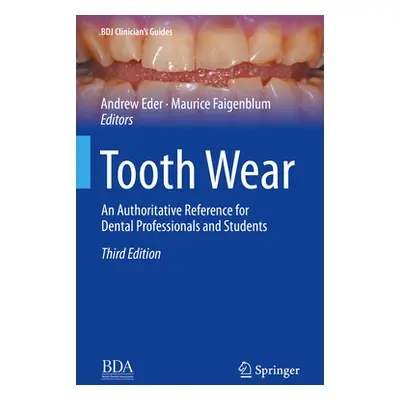 "Tooth Wear: An Authoritative Reference for Dental Professionals and Students" - "" ("Eder Andre