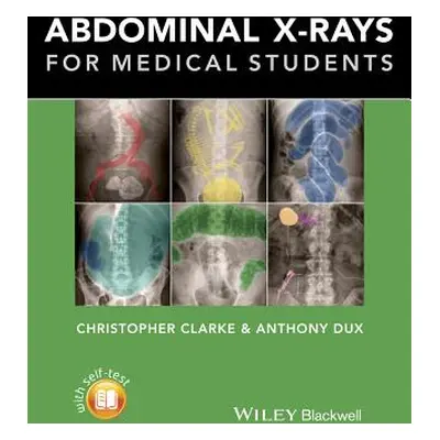 "Abdominal X-Rays for Medical Students" - "" ("Clarke Christopher")