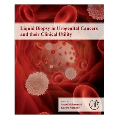 "Liquid Biopsy in Urogenital Cancers and Its Clinical Utility" - "" ("Kazem Aghamir Seyed Mohamm