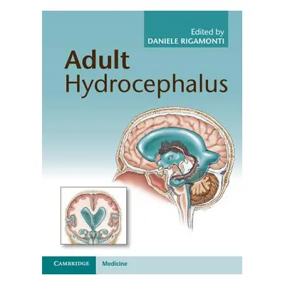 "Adult Hydrocephalus" - "" ("Rigamonti Daniele")