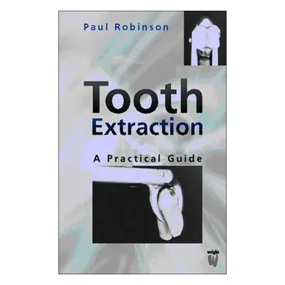 "Tooth Extraction: A Practical Guide" - "" ("Robinson Paul D.")