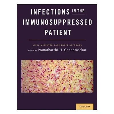 "Infections in the Immunosuppressed Patient: An Illustrated Case-Based Approach" - "" ("Chandras