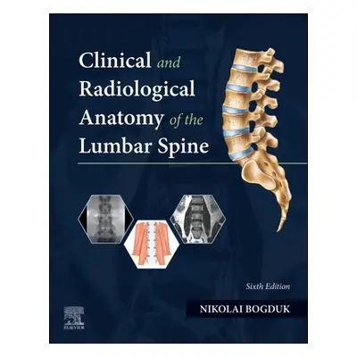 "Clinical and Radiological Anatomy of the Lumbar Spine" - "" ("Bogduk Nikolai")