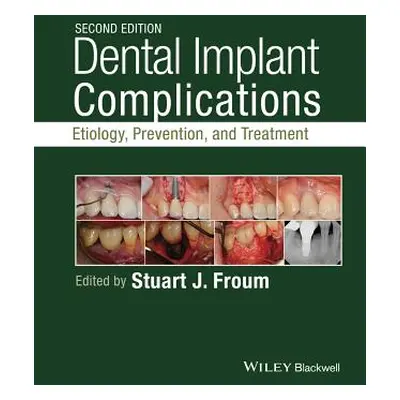 "Dental Implant Complications: Etiology, Prevention, and Treatment" - "" ("Froum Stuart J.")