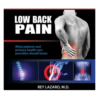 "Low Back Pain, What patients and primary care health care providers should know" - "" ("Lazaro 