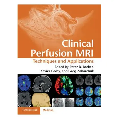 "Clinical Perfusion MRI: Techniques and Applications" - "" ("Barker Peter B.")