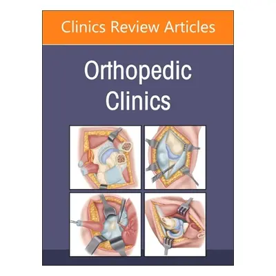 "Tumors, an Issue of Orthopedic Clinics: Volume 54-1" - "" ("Azar Frederick M.")