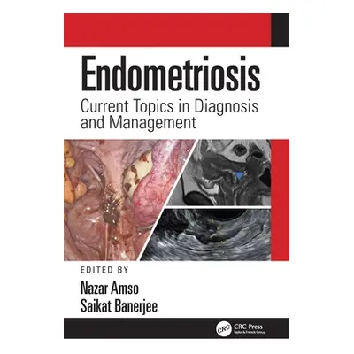 "Endometriosis: Current Topics in Diagnosis and Management" - "" ("Amso Nazar")