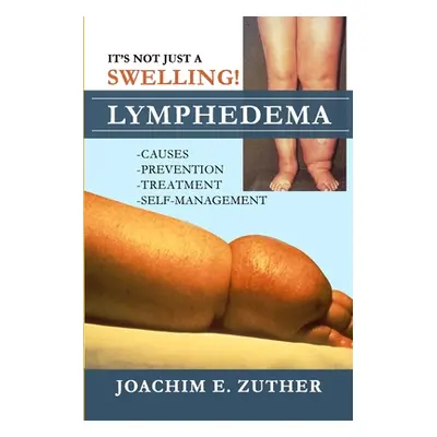 "It's Not Just a Swelling! Lymphedema: Causes, Prevention, Treatment, Self-Management" - "" ("Zu